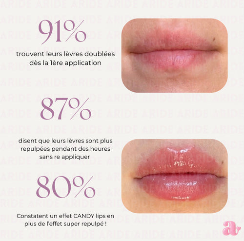 LipCream Magic Boost - Repulpe vos lèvres en 9 minutes !
