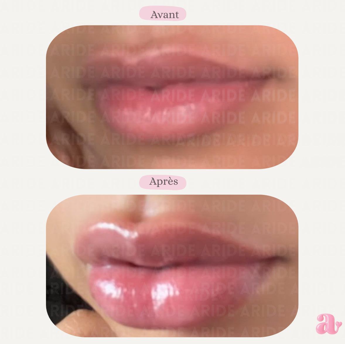 LipCream Magic Boost - Repulpe vos lèvres en 9 minutes !